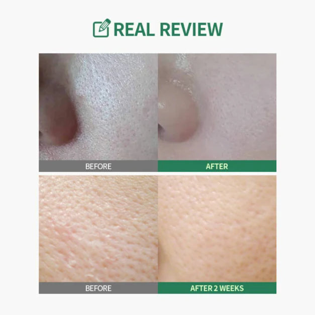 Sungboon Editor Green Tomato Pore Lifting Ampoule+ 60ml (2 x 30ml bottles)