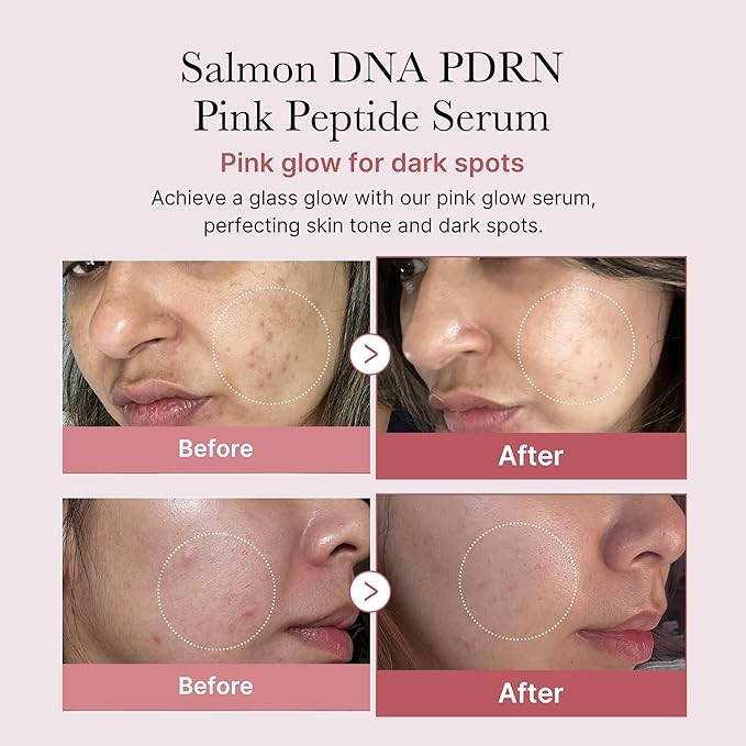 medicube PDRN Pink Peptide Ampoule 60ml (2 x 30ml bottles)