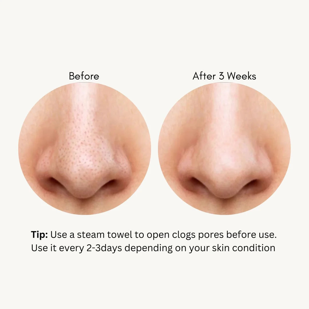 TONYMOLY Tako Pore Blackhead Scrub Stick